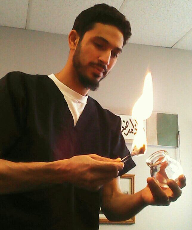cupping ali close2 1