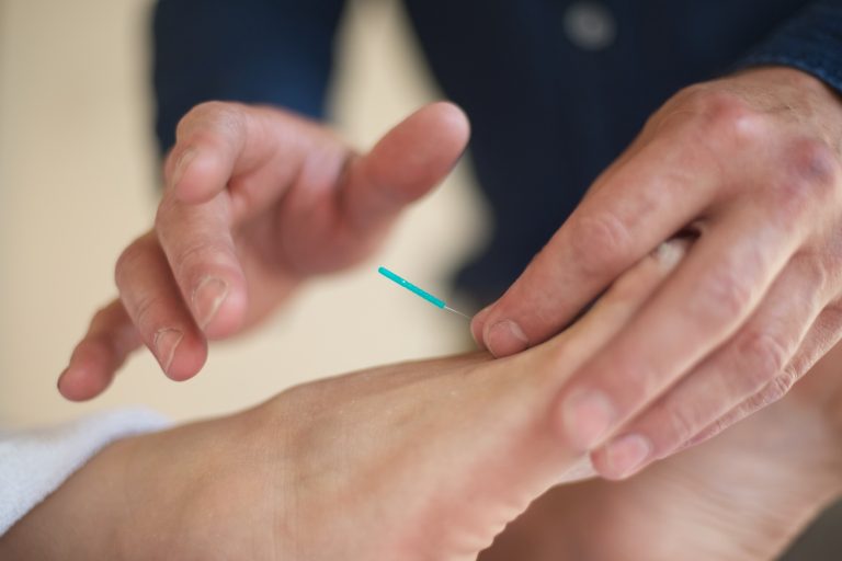 rescue acupuncture 9 768x512
