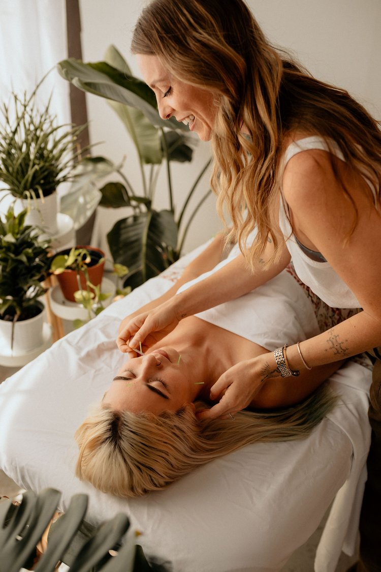 acupuncture ann arbor aligned acupuncture acupuncture ann arbor aligned acupuncture