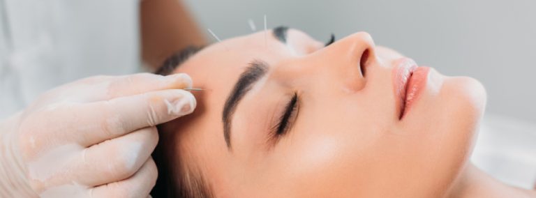 best-acupuncture-oc-1-851-315 best-acupuncture-oc-1-851-315