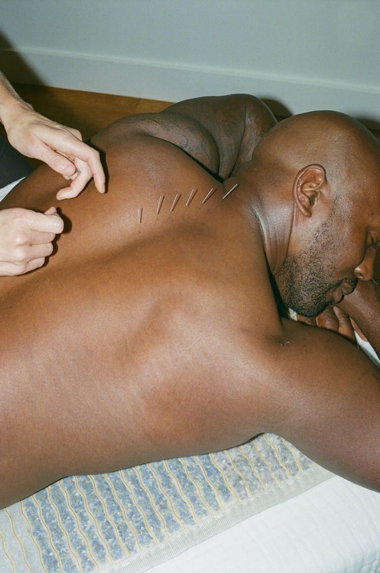 Pointe Acupuncture Pointe Acupuncture