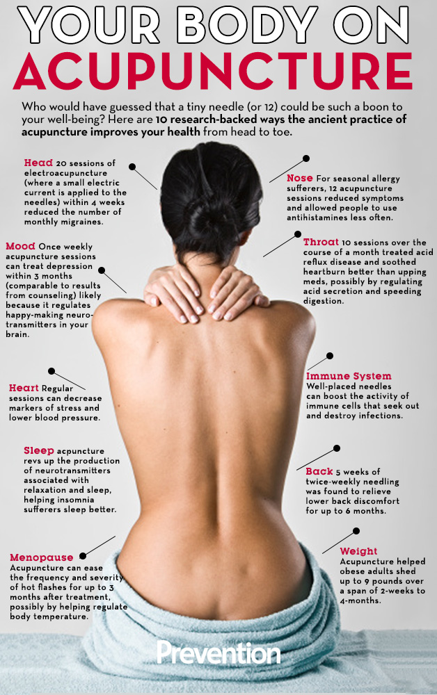 Accupuncture Info Graphic 1