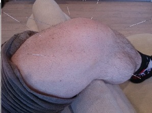 KNEE
