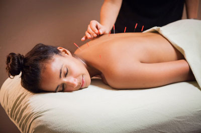 acupuncture Mesa