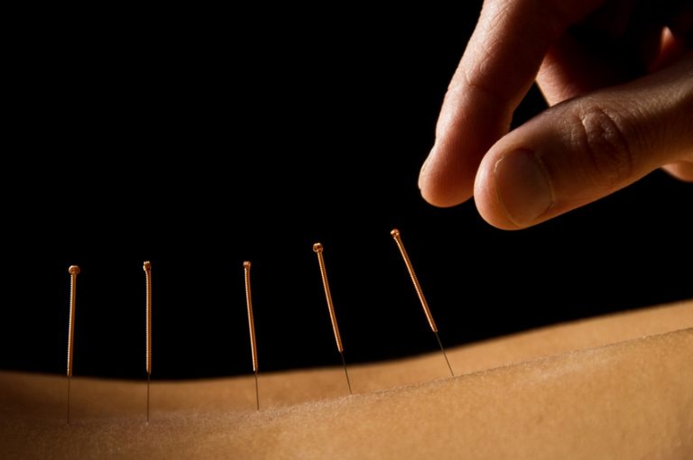 back-pain back-pain