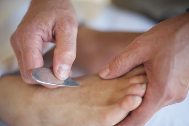 rescue acupuncture 10 768x513
